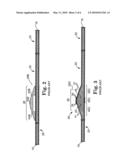 DIRECTIONAL ROTATIONAL ATHERECTOMY DEVICE WITH OFFSET SPINNING ABRASIVE ELEMENT diagram and image