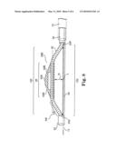 DIRECTIONAL ROTATIONAL ATHERECTOMY DEVICE WITH OFFSET SPINNING ABRASIVE ELEMENT diagram and image