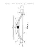 DIRECTIONAL ROTATIONAL ATHERECTOMY DEVICE WITH OFFSET SPINNING ABRASIVE ELEMENT diagram and image