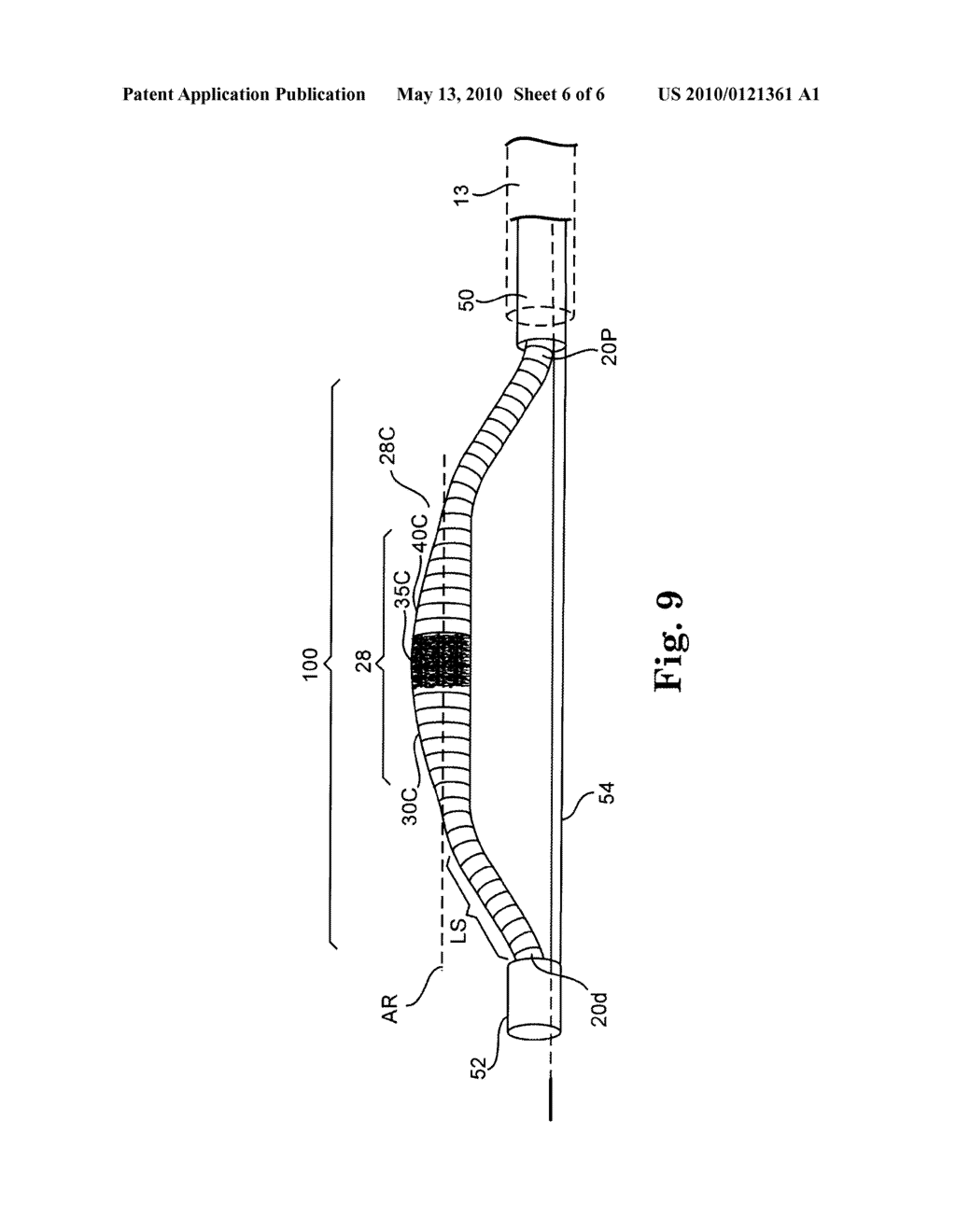DIRECTIONAL ROTATIONAL ATHERECTOMY DEVICE WITH OFFSET SPINNING ABRASIVE ELEMENT - diagram, schematic, and image 07