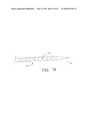 VESSEL SUPPORT DEVICE AND METHOD OF VESSEL HARVESTING diagram and image