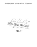 VESSEL SUPPORT DEVICE AND METHOD OF VESSEL HARVESTING diagram and image