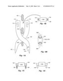 PEDICLE AND NON-PEDICLE BASED INTERSPINOUS AND LATERAL SPACERS diagram and image