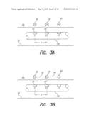 Optimizing Pitch Allocation in a Cochlear Implant diagram and image