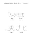 PERCUTANEOUS TRANSVALVULAR INTRANNULAR BAND FOR MITRAL VALVE REPAIR diagram and image