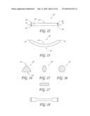 PERCUTANEOUS TRANSVALVULAR INTRANNULAR BAND FOR MITRAL VALVE REPAIR diagram and image