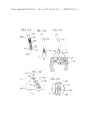 PERCUTANEOUS TRANSVALVULAR INTRANNULAR BAND FOR MITRAL VALVE REPAIR diagram and image