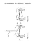 PERCUTANEOUS TRANSVALVULAR INTRANNULAR BAND FOR MITRAL VALVE REPAIR diagram and image