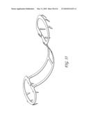 PERCUTANEOUS TRANSVALVULAR INTRANNULAR BAND FOR MITRAL VALVE REPAIR diagram and image