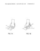 Torsion Control Devices and Related Articles of Footwear diagram and image