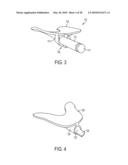 Torsion Control Devices and Related Articles of Footwear diagram and image