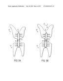 Torsion Control Devices and Related Articles of Footwear diagram and image