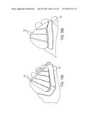 Torsion Control Devices and Related Articles of Footwear diagram and image