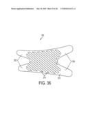 Torsion Control Devices and Related Articles of Footwear diagram and image