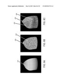 METHODS AND APPARATUS FOR COMBINED 4D PRESENTATION OF QUANTITATIVE REGIONAL PARAMETERS ON SURFACE RENDERING diagram and image