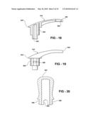 BONE CEMENT MIXER WITH TWO PADDLES, THE PADDLES ARRANGED TO LIMIT LONGITUDINAL MOVEMENT diagram and image