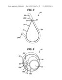 METHODS AND DEVICES FOR ENDOSCOPE CONTROL IN A BODY CAVITY diagram and image