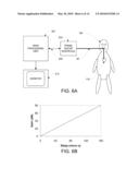 TRANSESOPHAGEAL ULTRASOUND USING A NARROW PROBE diagram and image