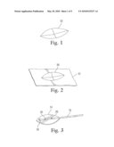 IMPLANT FOR USE IN SURGERY FOR GLAUCOMA AND A METHOD diagram and image