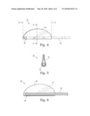 IMPLANT FOR USE IN SURGERY FOR GLAUCOMA AND A METHOD diagram and image