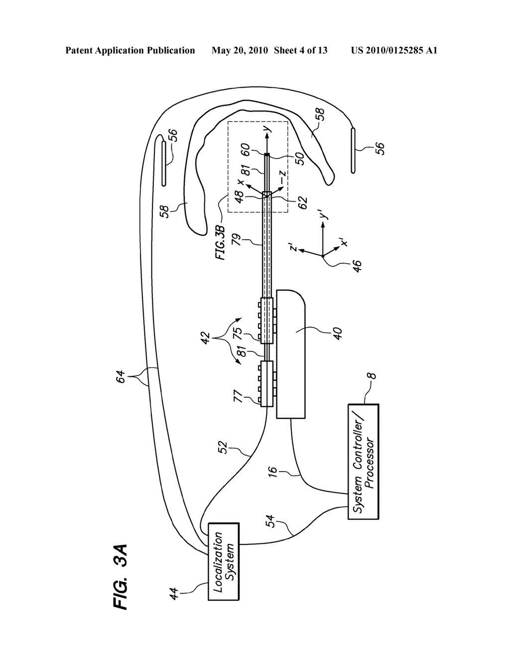 AUTOMATED ALIGNMENT - diagram, schematic, and image 05