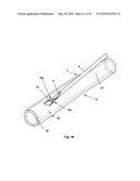 BIOLOGICAL TISSUE CLOSURE DEVICE AND METHOD diagram and image