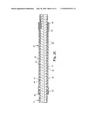 EPTFE FILL OF COIL FILAR GAPS diagram and image