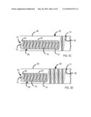 Coil Stent Delivery System and Method of Use diagram and image