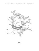 Self-retaining artificial spinal disc, and associated methods diagram and image