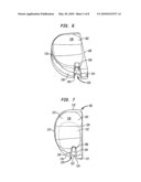 Trial implant and method of use diagram and image