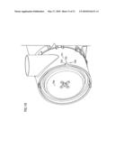 Air cleaner; replaceable filter cartridges; and, methods diagram and image