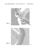 Mounting Assembly For A Stent And A Method Of Using The Same To Coat A Stent diagram and image