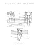 AIRWAY DEVICE diagram and image