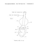 AIRWAY DEVICE diagram and image