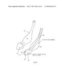 AIRWAY DEVICE diagram and image