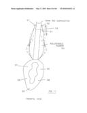 AIRWAY DEVICE diagram and image