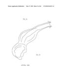 AIRWAY DEVICE diagram and image