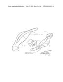 AIRWAY DEVICE diagram and image