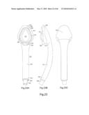 AIRWAY DEVICE diagram and image