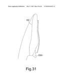 AIRWAY DEVICE diagram and image