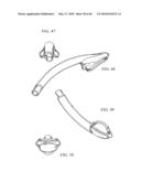 AIRWAY DEVICE diagram and image