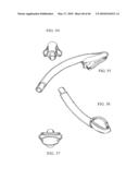 AIRWAY DEVICE diagram and image