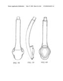 AIRWAY DEVICE diagram and image