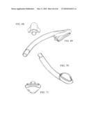 AIRWAY DEVICE diagram and image