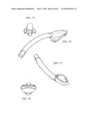 AIRWAY DEVICE diagram and image