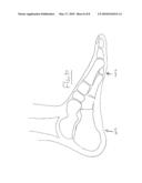 LEG LIFT DEVICE AND ASSOCIATED METHOD diagram and image