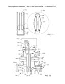 IN SITU RECOVERY FROM A HYDROCARBON CONTAINING FORMATION diagram and image