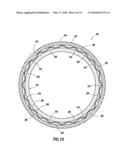 Use of Swellable Material in an Annular Seal Element to Prevent Leakage in a Subterranean Well diagram and image