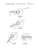 CHARGED PARTICLE CANCER THERAPY DOSE DISTRIBUTION METHOD AND APPARATUS diagram and image