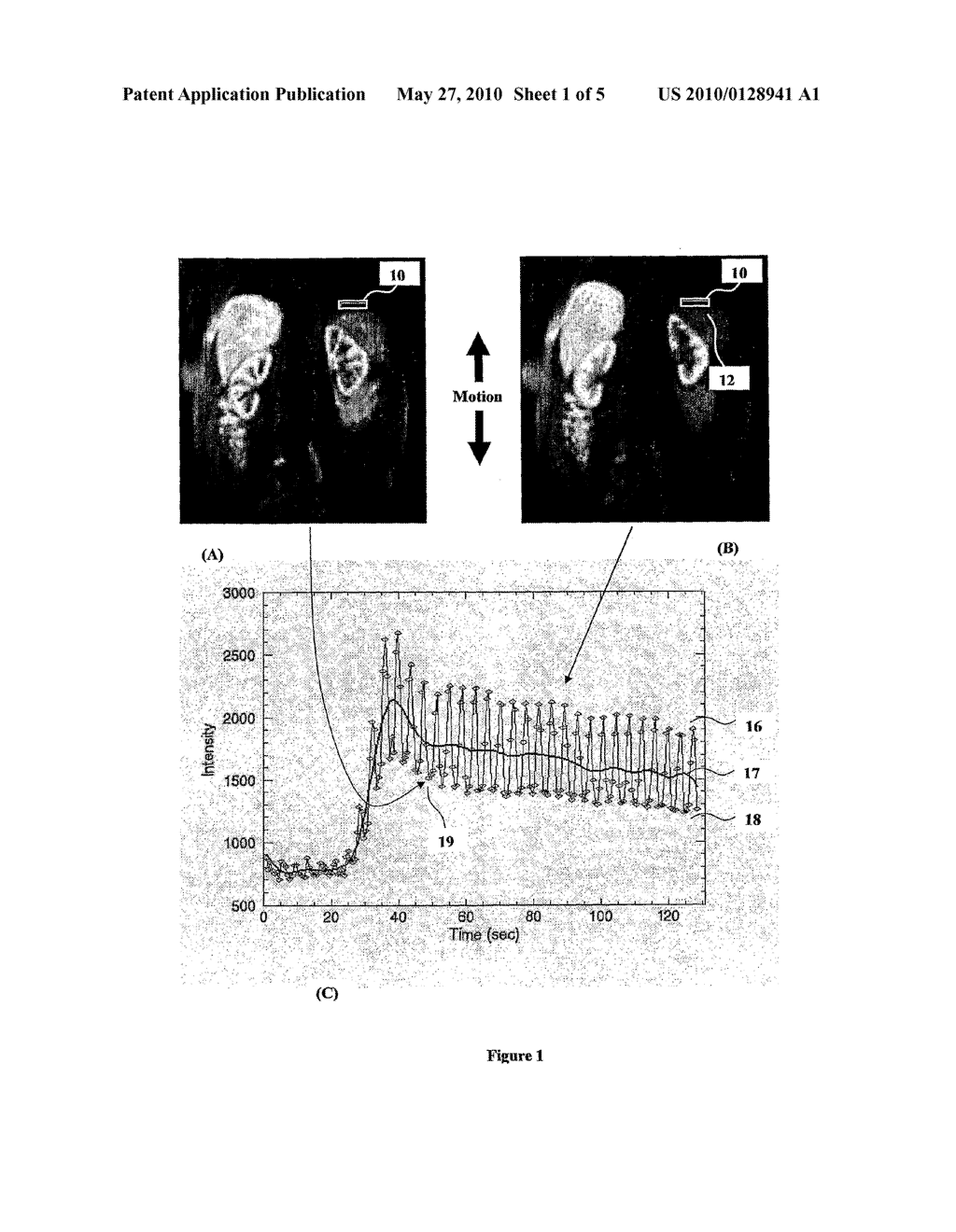 Method and System of Motion Artefact Compensation in a Subject - diagram, schematic, and image 02